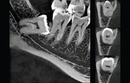 3D - Röntgen / Digitale Volumentomographie (DVT)