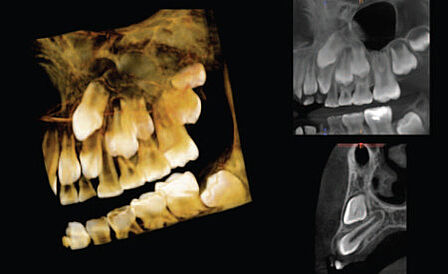 3D - Röntgen / Digitale Volumentomographie (DVT) 3D - Röntgen / Digitale Volumentomographie (DVT)